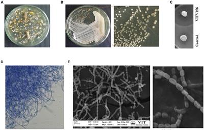 Genomic insights into an endophytic Streptomyces sp. VITGV156 for antimicrobial compounds